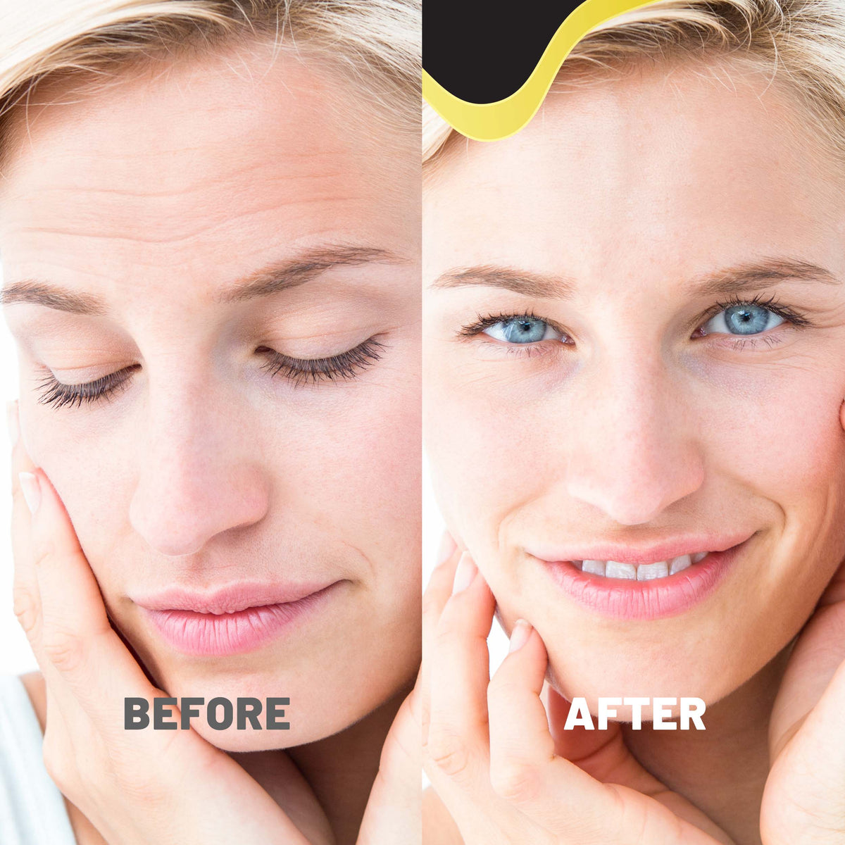 Forehead Wrinkle Patches, Smooth Fine Lines & Wrinkles, Anti-Wrinkle Strips for All Skin Types, 12 patches